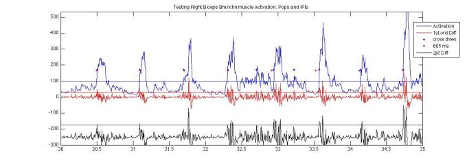 PopsIPIs Electrical Potential, first order difference and 2nd degree first order difference data from Biceps pops