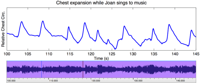 respsample_joansinging